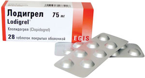 ლოდიგრელი