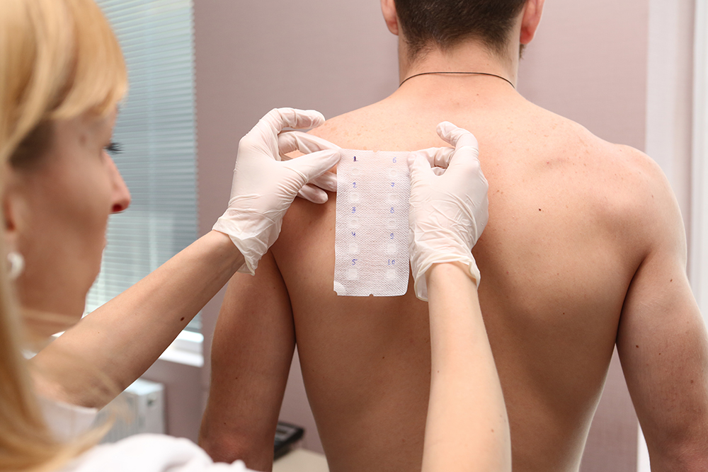 ალერგიისა და იმუნოლოგიის ცენტრი