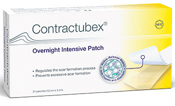 კონტრაკტუბექსი