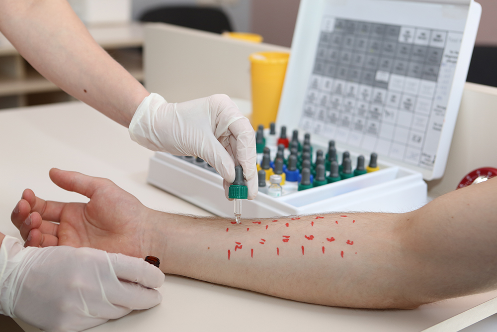 ალერგიისა და იმუნოლოგიის ცენტრი