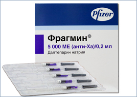 ფრაგმინი